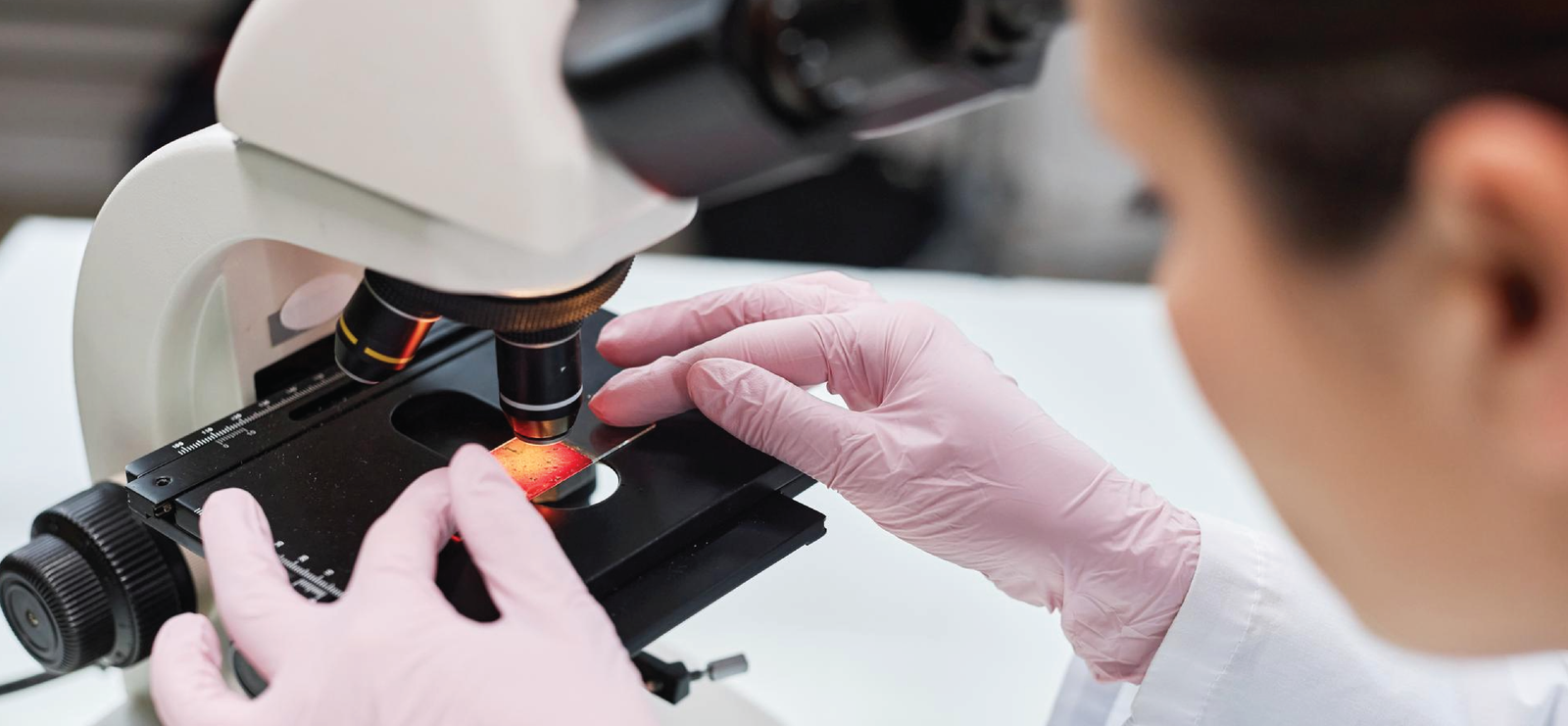 Dried blood pattern evaluation